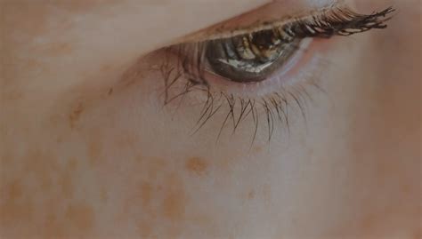 Fade Face Sunspots: What Works, What Doesn't