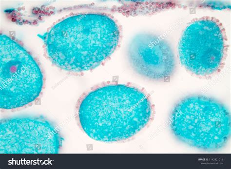 Image result for Flower Pollen Under Microscope