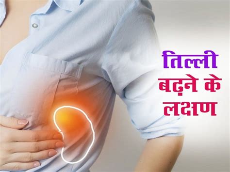Mild Splenomegaly Meaning In Hindi: हल्की तिल्ली बढ़ने का मतलब, लक्षण ...