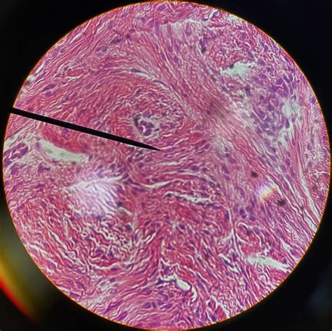 Fibrocartilage under a microscope | Things under a microscope ...