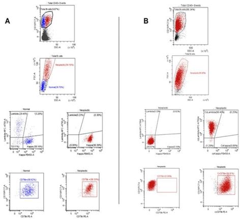Heterogeneous Surface CD79b Expression in Aggressive B-Cell Lymphomas ...