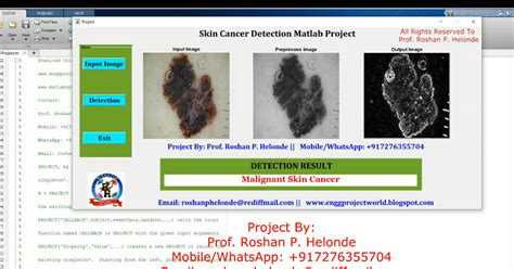Image result for Skin Disease Detection Using MATLAB
