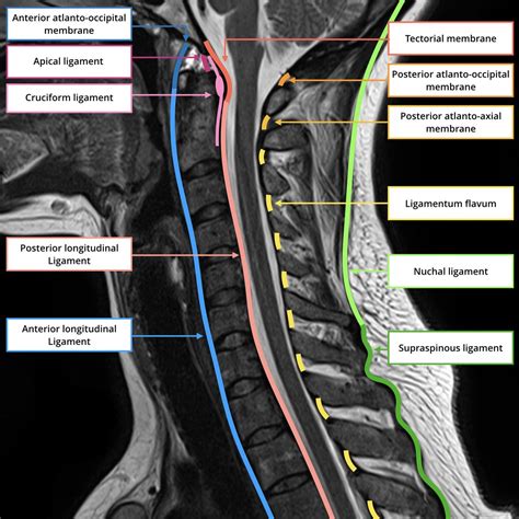 Ct Anatomy Of Cervical Spine at Norma Cuellar blog