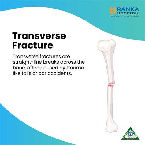 Linear Fracture Definition Transverse Fracture Royalty Free Images,