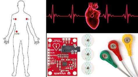 ECG Monitoring system ( Ready made ) – SKYNET ROBOTICS