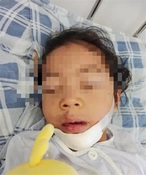 生命的奇迹！江西4岁女童坠楼昏迷90天后苏醒，网友：必有后福