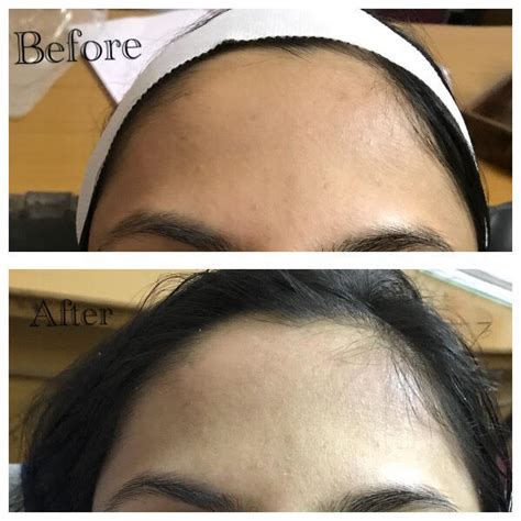 Gallery - Dermaplus