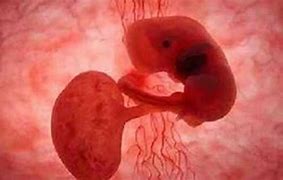 胎儿 的图像结果
