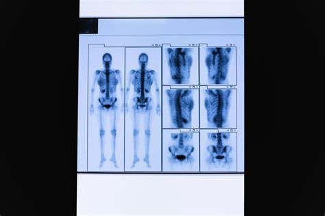 Image result for Body Parts Scan