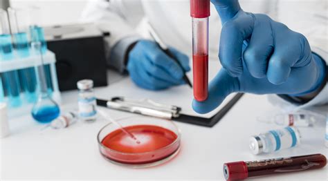 Lab Test 的图像结果