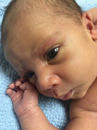 Baby eye color changes tracking | BabyCenter