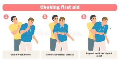 Choking First Aid Infographic Poster with Adults Rescue Stock Vector ...