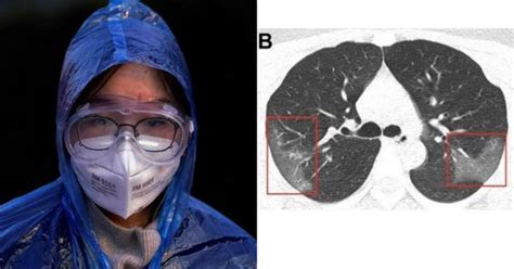 High Time We Wear Our Masks Properly As Study Says Coronavirus May ...