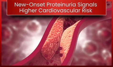 New-Onset Proteinuria (NOP) During Hospitalization: A Critical ...