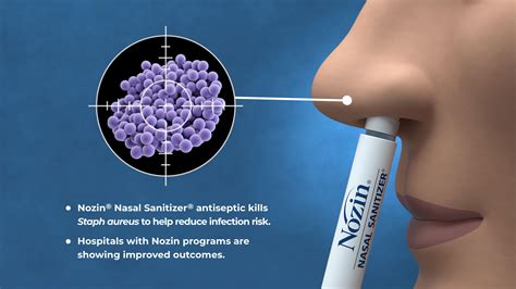 Nozin Nasal Sanitizer Programs Reduce MRSA Infections