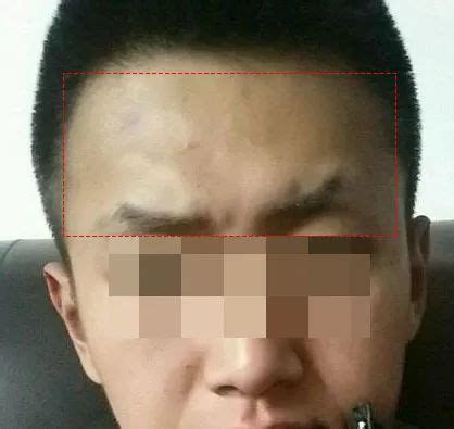 你以为印堂发黑预示着血光之灾？其实……_腾讯新闻