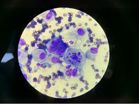 Histiocytic Sarcoma in Dogs: Signs, Diagnosis & Treatment Options ...
