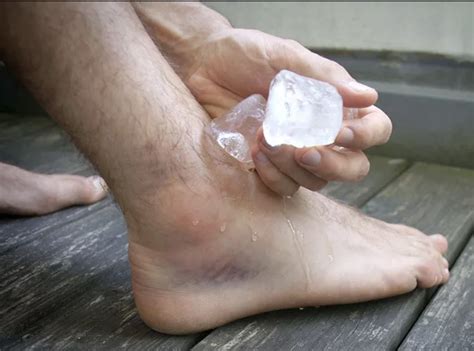 Sprain First Aid 的图像结果