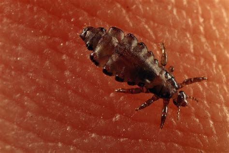 Head Lice Bug