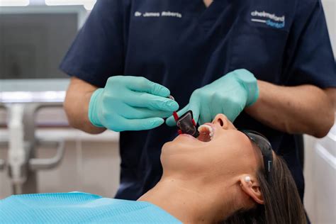 Types of Dental Bridges: Which Is Best For YOU!