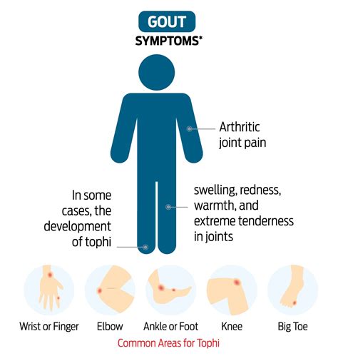 Gout vs Rheumatoid Arthritis - IMU University
