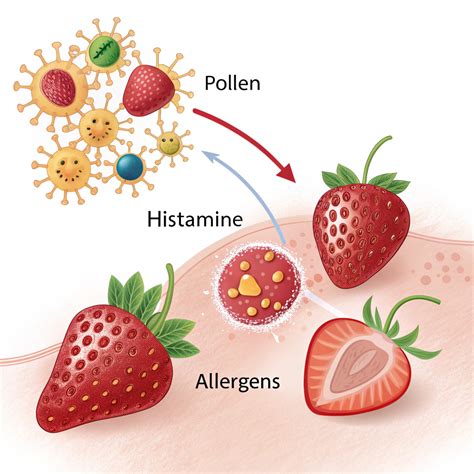 Why Do Strawberries Make My Child’s Tongue Itchy? Understanding Oral Allergy Syndrome ...