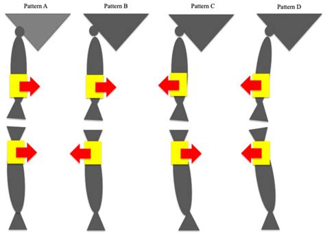 A Novel Classification of Coronal Plane Knee Joint Instability Using ...