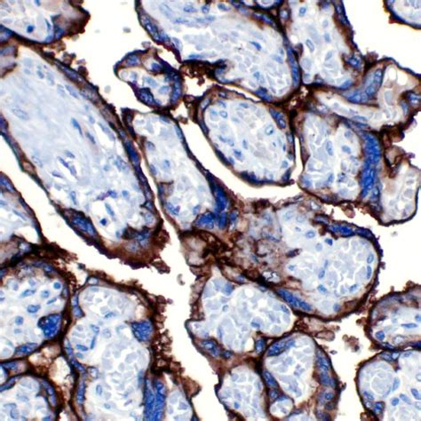 PLAP-EP194 | PathnSitu Biotechnologies
