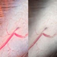 Image result for KEYENCE Microscope