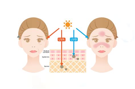 Physical vs Chemical Sunscreen: Discover the Best for Your Skin – Blue ...