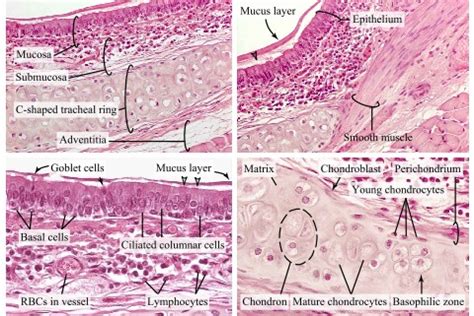 Image result for Visual Growing Patterns