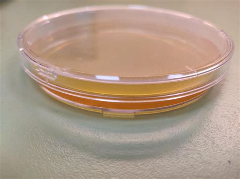 What is the best way to incubate agar? agar side up or down? and why ...