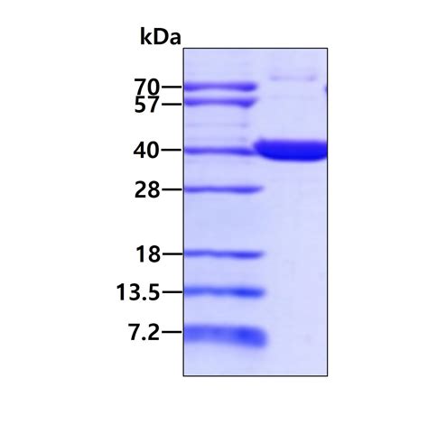 Recombinant Human ALAS2/ASB protein (ab79941) | Abcam