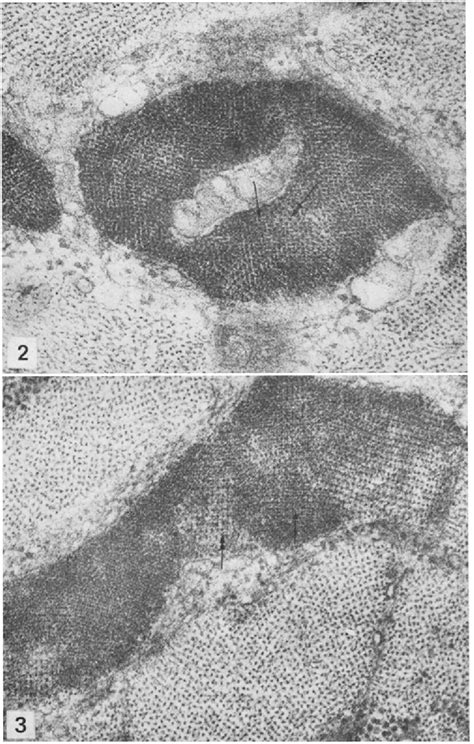 Image result for Muscle Fiber Z-Line