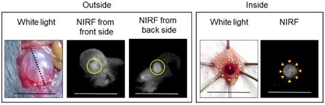 In Vivo Optical Imaging of Bladder Cancer Tissues in an MB49 Bladder ...