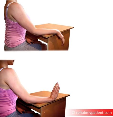 Image result for Distal Radius Fracture Recovery