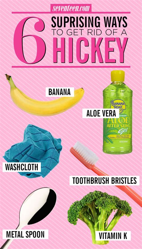 Outstanding Tips About How To Get Rid Of Hickies Quickly - Usualadult