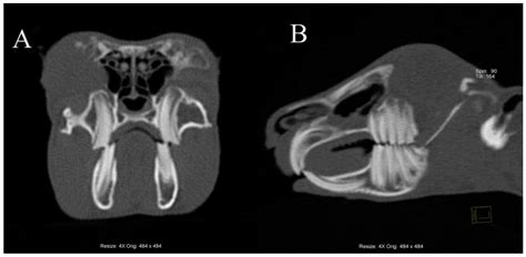 Computed Tomographic Findings of Dental Disease and Secondary Diseases of the Head Area in ...