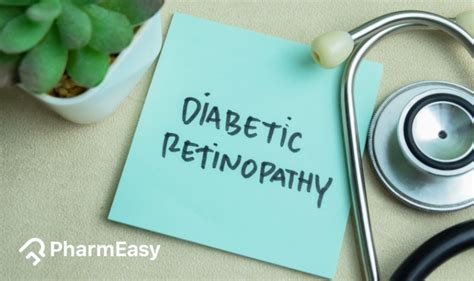 What is Diabetic Retinopathy: Causes, Symptoms & Treatment | PharmEasy ...