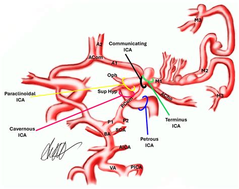 Anterior Cerebral Artery