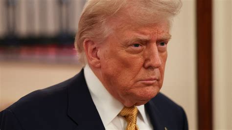 Trump's diagnosis: what is chronic venous insufficiency?