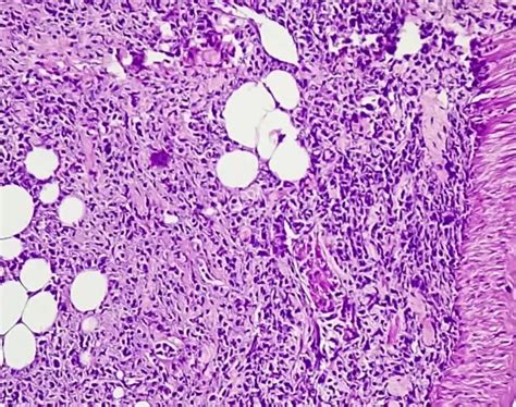 Onkologie | Fachzeitschrift Onkologie und Transplantationsmedizin