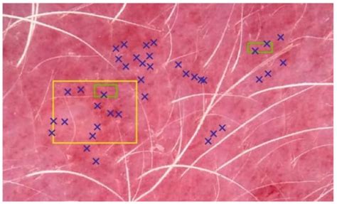 Evaluation of Erythema Severity in Dermatoscopic Images of Canine Skin ...