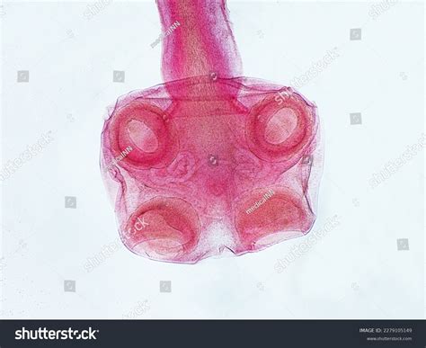 481 Tapeworm Scolex Images, Stock Photos & Vectors | Shutterstock