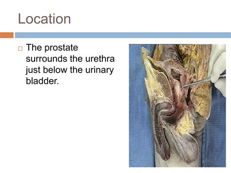 Prostate | PPTX