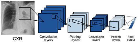 Chest X-ray Abnormality Detection by Using Artificial Intelligence: A ...