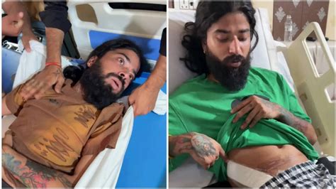 Anurag Dobhal in unbearable pain as his right leg is ‘totally numb ...