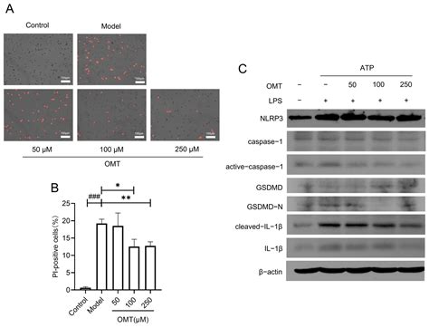 Oxymatrine Attenuates Ulcerative Colitis through Inhibiting Pyroptosis ...