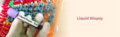 Liquid Biopsy: A Simple Blood Test For Early Cancer Detection