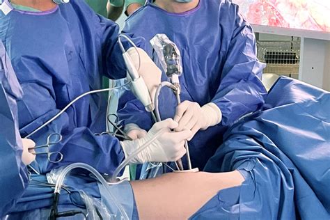 Is Early Stage Lung Cancer Curable? Understand Your Diagnosis & Treatment